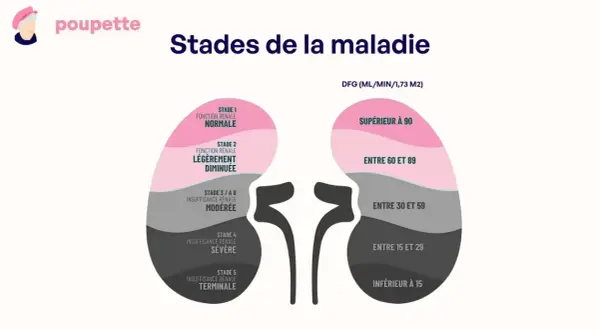 Schéma des stades de la maladie rénale, de la fonction normale à l'insuffisance terminale. Un taux de créatinine haut peut indiquer ces stades avancés.