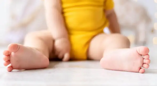 Dziecko w żółtym body siedzi na podłodze. Widoczne są jego stópki, które mogą sugerować płaskostopie u dzieci.
