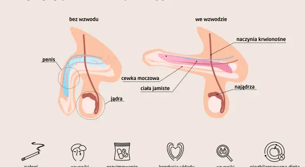 Ilustracja pokazuje budowę penisa bez i we wzwodzie, wyjaśniając przyczyny impotencji. Wymieniono nałogi, czynniki psychologiczne i inne.