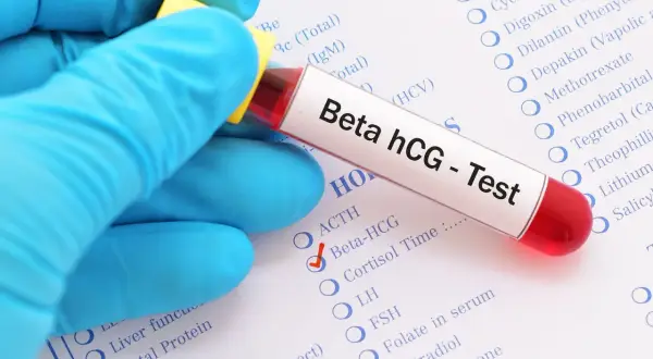 Ręka w niebieskiej rękawiczce trzyma probówkę z krwią do testu Beta hCG. Czerwony znaczek obok "Beta-HCG" sugeruje, że badanie jest wykonywane, aby sprawdzić, dlaczego beta hcg spada.