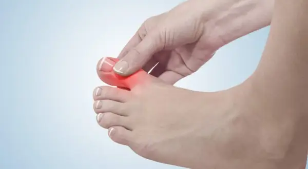 Schmerzender Zeh, möglicherweise durch Überlastung des extensor hallucis longus.