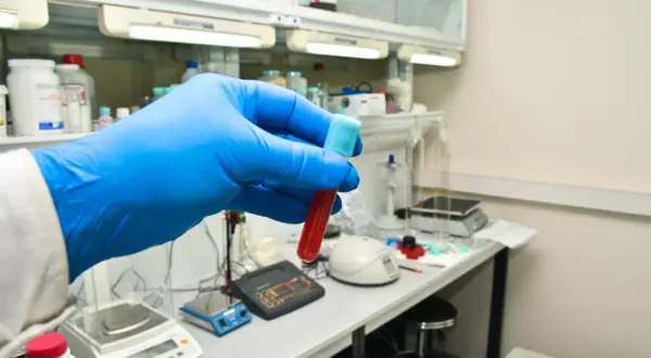 Ręka w niebieskiej rękawiczce trzyma probówkę z krwią. W tle laboratorium, gdzie badane są bazofile podwyższone u dziecka.