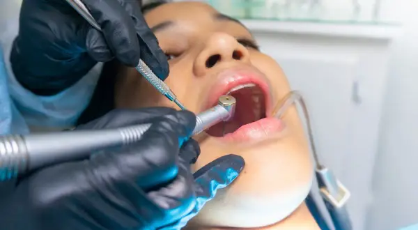 Znieczulenie u dentysty na NFZ: Kiedy jest bezpłatne i co musisz wiedzieć?