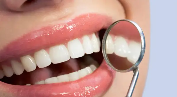 Uśmiech z lśniącymi zębami, badany lusterkiem dentystycznym. Zdrowe dziąsła to podstawa, by uniknąć problemów jak szkorbut.
