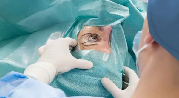 Oko pacjenta podczas zabiegu laserowej korekcji wzroku, przygotowywane przez chirurga w rękawiczkach.