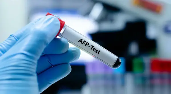 Badanie AFP - co to za badanie i dlaczego jest tak ważne?