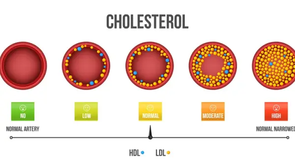 Jaki cholesterol jest dobry i jak poprawić jego poziom w organizmie