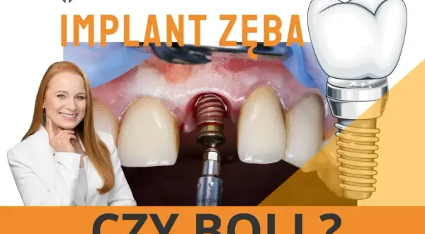 Implant zęba czy boli? Uśmiechnięta dentystka i zbliżenie na implant w trakcie zabiegu.