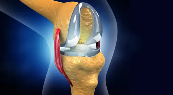 Knieprothese im Detail. Nach einer Meniskus-OP wie lange krank? Rehabilitation ist entscheidend.