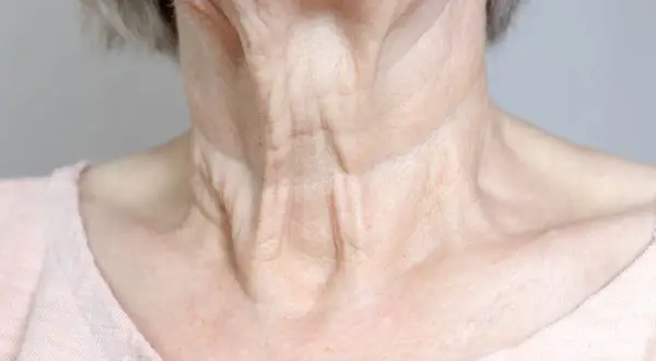 Primer plano del cuello de una mujer mayor, mostrando las arrugas del cuello y la piel con textura.