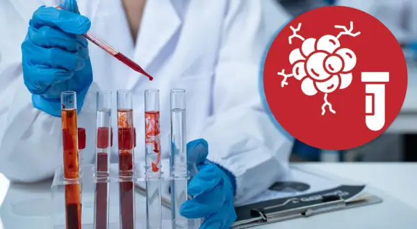 Laborant mit blauen Handschuhen tropft Blut in Reagenzgläser. Symbol für Tumormarker im Blut.