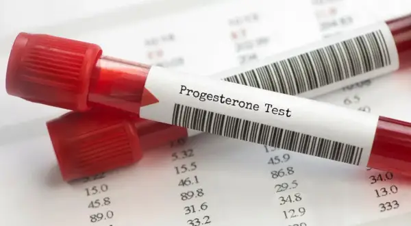 Dwie probówki z krwią oznaczone "Progesterone Test" leżą na papierze z wynikami badań. Kluczowe dla monitorowania progesteronu w ciąży.
