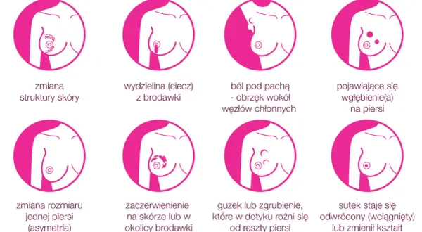 Osiem objawów raka piersi: zmiana struktury skóry, wydzielina z brodawki, ból pod pachą, wgłębienie, asymetria, zaczerwienienie, guzek, odwrócony sutek. Tu mammae dex to znaczy rak piersi.