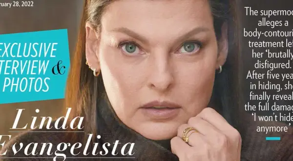 Kriolipoliza czy liposukcja kawitacyjna? Ekspert radzi!