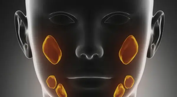 Anatomia ślinianek z widocznymi ogniskami kamicy. Złote plamy symbolizują kamienie w śliniankach.