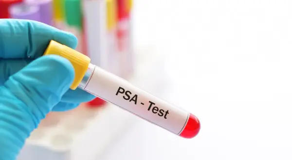 Ręka w niebieskiej rękawiczce trzyma probówkę z krwią do badania prostaty (PSA - Test). W tle widać inne probówki.