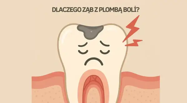 Smutny ząb z próchnicą i bólem, być może przez za wysoka plomba. Czerwone błyskawice symbolizują ból.