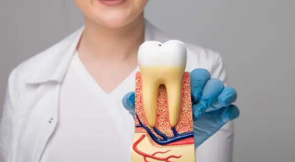 Model zęba z widocznymi korzeniami i naczyniami krwionośnymi. Dentysta wyjaśnia, ile trwa obumieranie zęba.