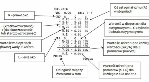 Jak czytać wyniki badania wzroku u okulisty i uniknąć błędów