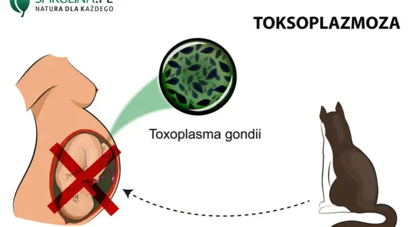 Toksoplazmoza a mózg: Objawy psychiczne, depresja i diagnostyka