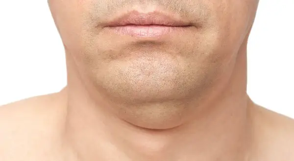 Primer plano de la barbilla y el cuello de un hombre, mostrando papada. Una imagen que ilustra cómo adelgazar la cara.