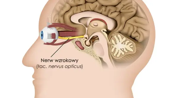 Przekrój głowy ukazujący oko i nerw wzrokowy. Zanik nerwu wzrokowego rokowania może wpływać na widzenie.