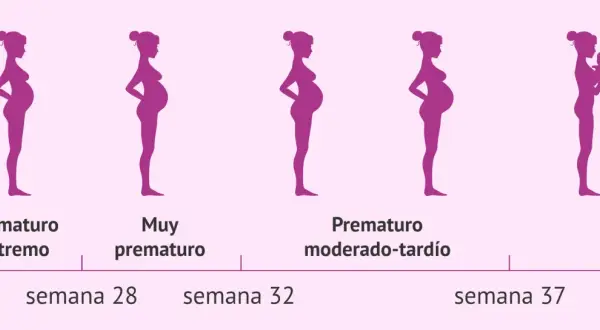 Siluetas de embarazos y un bebé. Muestran que a partir de la semana 28 puede nacer un bebé prematuro.