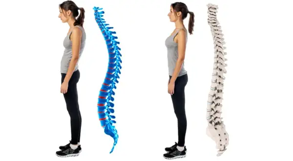 Postura scorretta e dolori addominali: confronto tra colonna vertebrale curva e dritta.