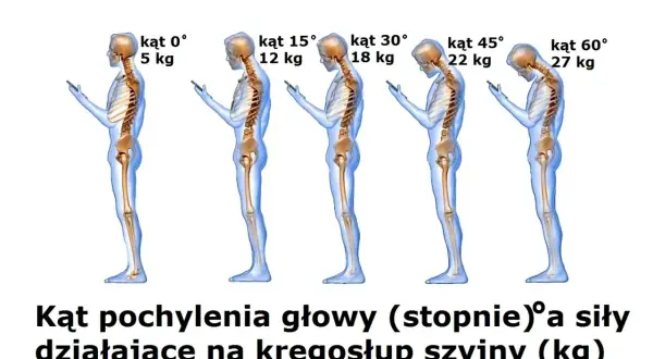 Schylanie się nad telefonem obciąża kręgosłup szyjny. Im większy kąt pochylenia głowy, tym większa siła działa na szyję.
