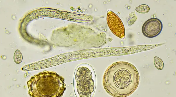 Microscopio muestra larvas y huevos de parásitos intestinales, como los que afectan a perros. Se observan gusanos y distintas formas de huevos.