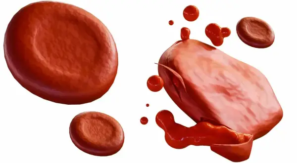 Czerwone krwinki, jedna z nich pęka, uwalniając zawartość. To obraz hemolizy, procesu rozpadu erytrocytów.