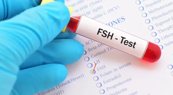 Rękawiczka w niebieskiej rękawiczce trzyma probówkę z napisem "FSH - Test". Obok zaznaczono opcję FSH na liście badań.