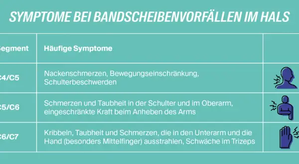 Tabelle zeigt Symptome bei HWS-Nerv-eingeklemmt-Fällen: Nackenschmerzen, Schulterbeschwerden, Taubheit im Arm, Kribbeln in der Hand.