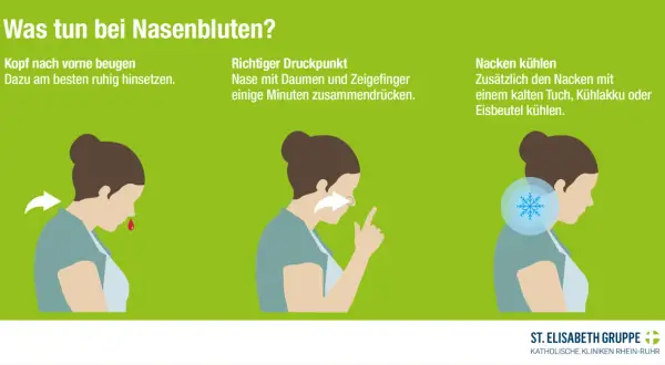 Bei Nasenbluten: Kopf vor, Nase drücken. Nacken kühlen mit einem kalten Lappen.