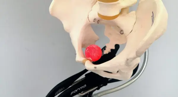 Modello anatomico del bacino su un supporto, con una sfera rossa posizionata per illustrare il dolore sellino bici.