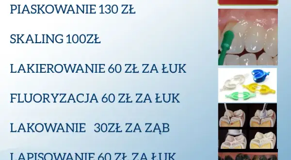 Ile kosztuje plomba u dentysty? Pełen cennik i porady eksperta