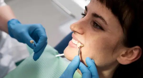 Dentysta dopasowuje kolor porcelany do lekko ukruszonego zęba. Cena zabiegu zależy od materiału.