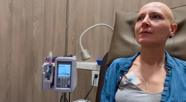 Kobieta po chemioterapii, która może być leczeniem raka jelita grubego. Przyczyny choroby są złożone.