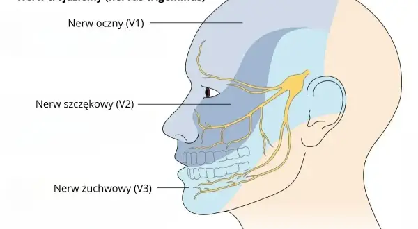 Ilustracja przedstawia unerwienie twarzy przez nerw trójdzielny. Zapalenie nerwu trójdzielnego od zęba może powodować silny ból.