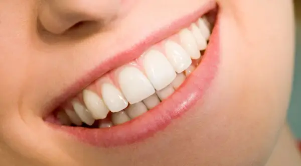 Uśmiech po zabiegu gingiwektomii. Piękne, białe zęby i zdrowe dziąsła.
