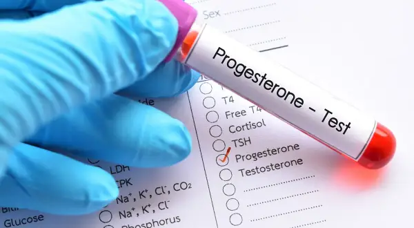 Rękawiczka trzyma probówkę z napisem "Progesteron - Test". Obok zaznaczono "Progesteron" na liście badań. Czy progesteron trzeba badać na czczo?