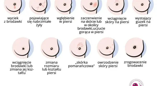 Samobadanie piersi: wyciek z brodawki, zaczerwienienie, guzek, zmiana kształtu. Poznaj sygnały, na które warto zwrócić uwagę.