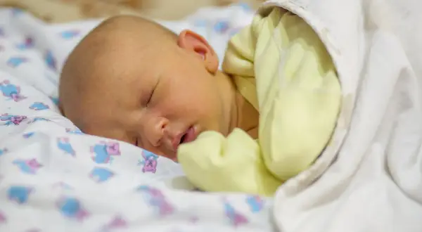 Bebé durmiendo con piel amarillenta, indicativo de bilirrubina alta en bebés.