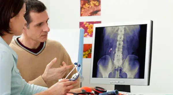 Medico e paziente esaminano una radiografia che mostra calcoli renali, possibile indicazione di malattia di Berger e potenziale invalidità.