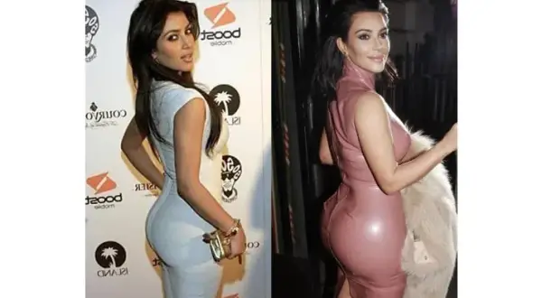 Kim Kardashian: Prawda o operacjach plastycznych i "efekcie BBL"