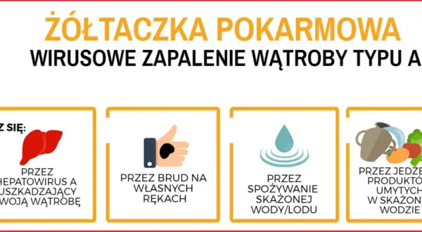 Żółtaczka pokarmowa to choroba zakaźna. Zakażenie wirusem A może nastąpić przez brudne ręce, skażoną wodę lub żywność.
