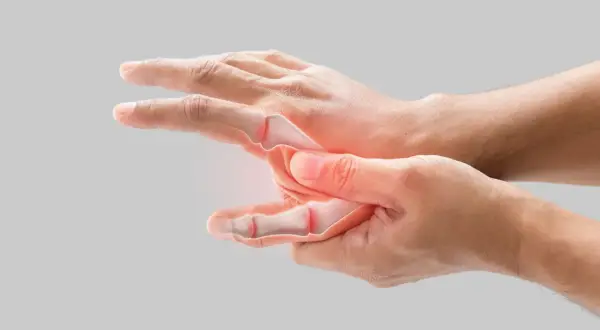 Main d'une personne montrant des articulations enflammées et une douleur extérieure au poignet, avec une visualisation des os.