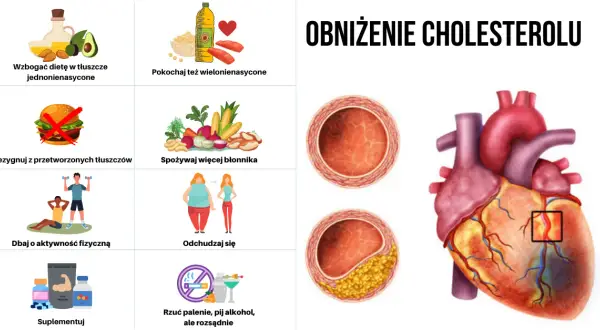 Czy cholesterol powoduje nadciśnienie? Odkryj niebezpieczne powiązania