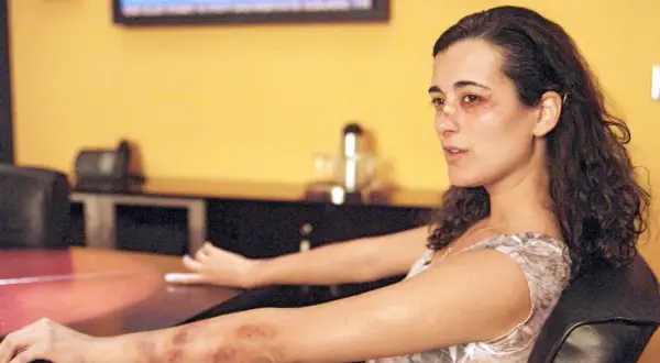 Cote de Pablo mit blauen Flecken im Gesicht und am Arm, sitzt nachdenklich in einem Stuhl.