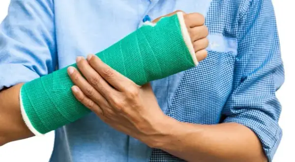 Złamana ręka – ile czasu trzeba nosić gips i co dalej?